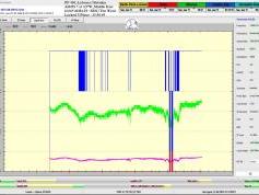 dxsatcs-amos-7-middle-east-sat-reception-prodelin-450cm-11 069-mhz-h-SBN-the Word tv-101h-signal-monitoring-A011