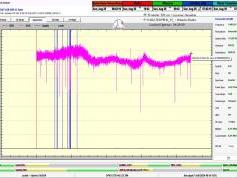 dxsatcs-eutelsat-21b-western-tpdw7-low-symbol-rate-radio-broadcasting-11602,760-Atlantis-radio-24H-monitoring-370-9.75-02