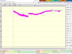 dxsatcs-eutelsat-21b-western-tpdw7-low-symbol-rate-radio-broadcasting-monitoring-11577-Medi1 Radio-Morocco-24h-snr-03