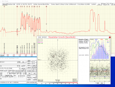 03-amos-7-H_Amos 11542H -lepsi, SNR 5,2Db. např. rozdil při doladění elevace, 3 pulsy 64PPI TBS